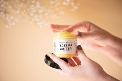 Eczema Butter (Scent: 4 oz. Eucalyptus-Chamomile)